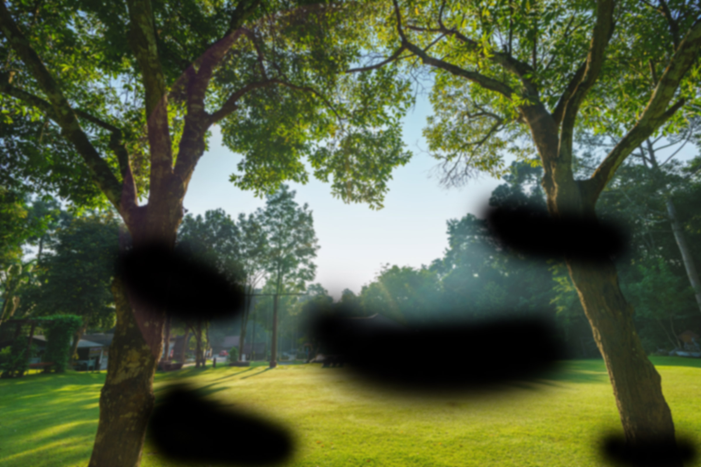 Diabetic Retinopathy vision of a lush green park with two large trees framing the view, with a small pavilion in the distance. Sunlight filters through the trees, casting gentle shadows on the grass - Eye Doctor Rolla MO